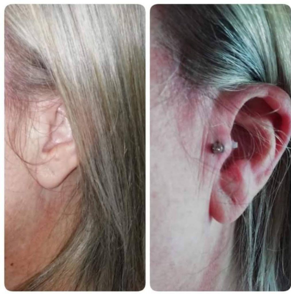 Absolute Beauty | Salon | Brackenfell | Skin | Hair | Nails | Beauty | Microblading | Facial | Plasma Pen | Waxing | Make Up | Spraytan | Highlights | Massage | Manicure | Pedicure | Aesthetics | Lashes | Eyelash extensions | Lemon Bottle