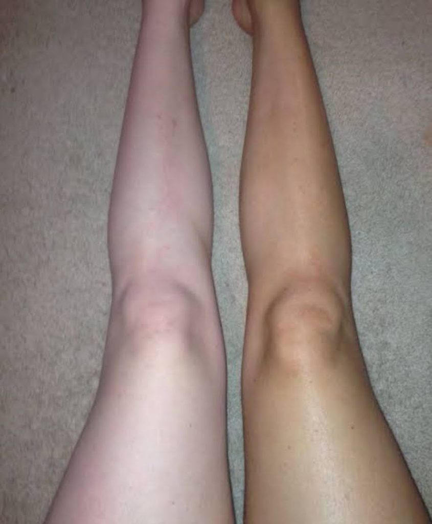 Absolute Beauty | Salon | Brackenfell | Skin | Hair | Nails | Beauty | Microblading | Facial | Plasma Pen | Waxing | Make Up | Spraytan | Highlights | Massage | Manicure | Pedicure | Aesthetics | Lashes | Eyelash extensions | Lemon Bottle