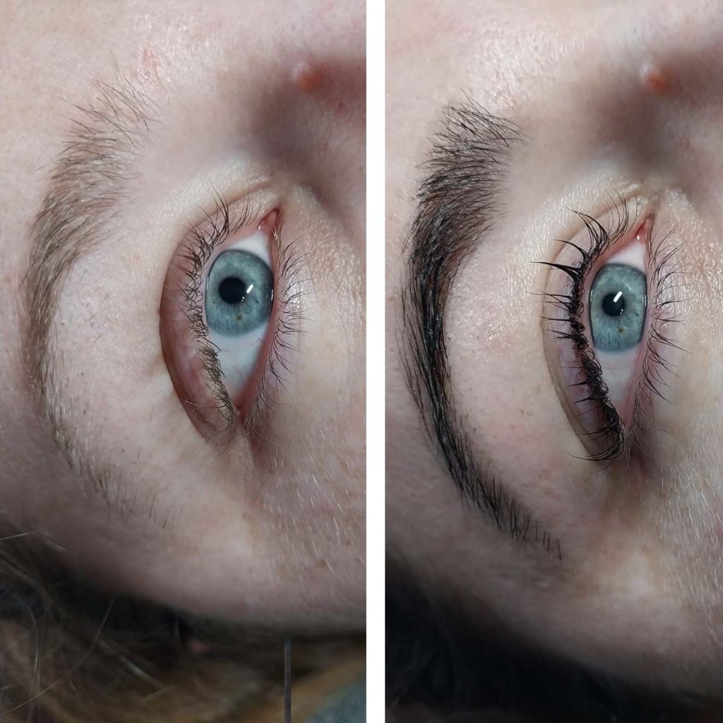 Absolute Beauty | Salon | Brackenfell | Skin | Hair | Nails | Beauty | Microblading | Facial | Plasma Pen | Waxing | Make Up | Spraytan | Highlights | Massage | Manicure | Pedicure | Aesthetics | Lashes | Eyelash extensions | Lemon Bottle