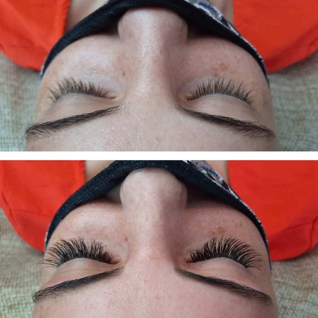 Absolute Beauty | Salon | Brackenfell | Skin | Hair | Nails | Beauty | Microblading | Facial | Plasma Pen | Waxing | Make Up | Spraytan | Highlights | Massage | Manicure | Pedicure | Aesthetics | Lashes | Eyelash extensions | Lemon Bottle