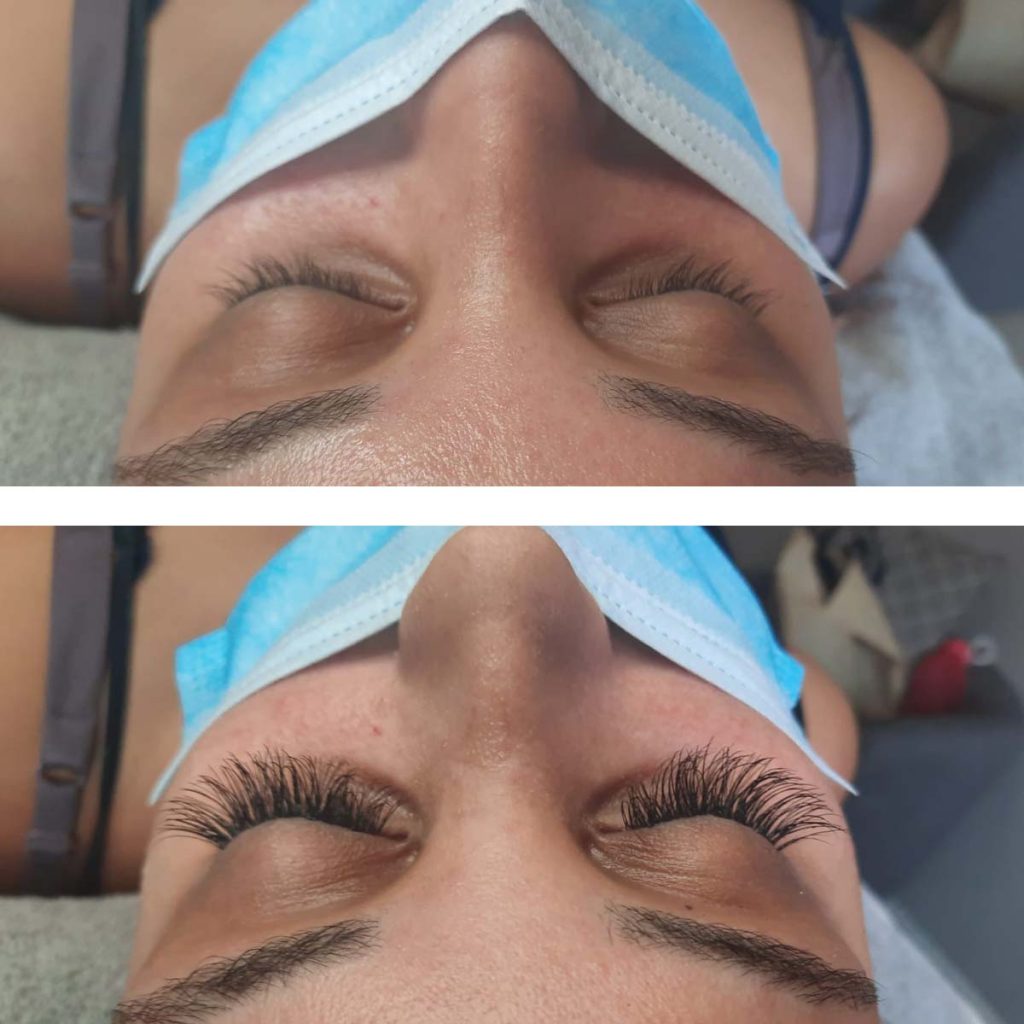 Absolute Beauty | Salon | Brackenfell | Skin | Hair | Nails | Beauty | Microblading | Facial | Plasma Pen | Waxing | Make Up | Spraytan | Highlights | Massage | Manicure | Pedicure | Aesthetics | Lashes | Eyelash extensions | Lemon Bottle